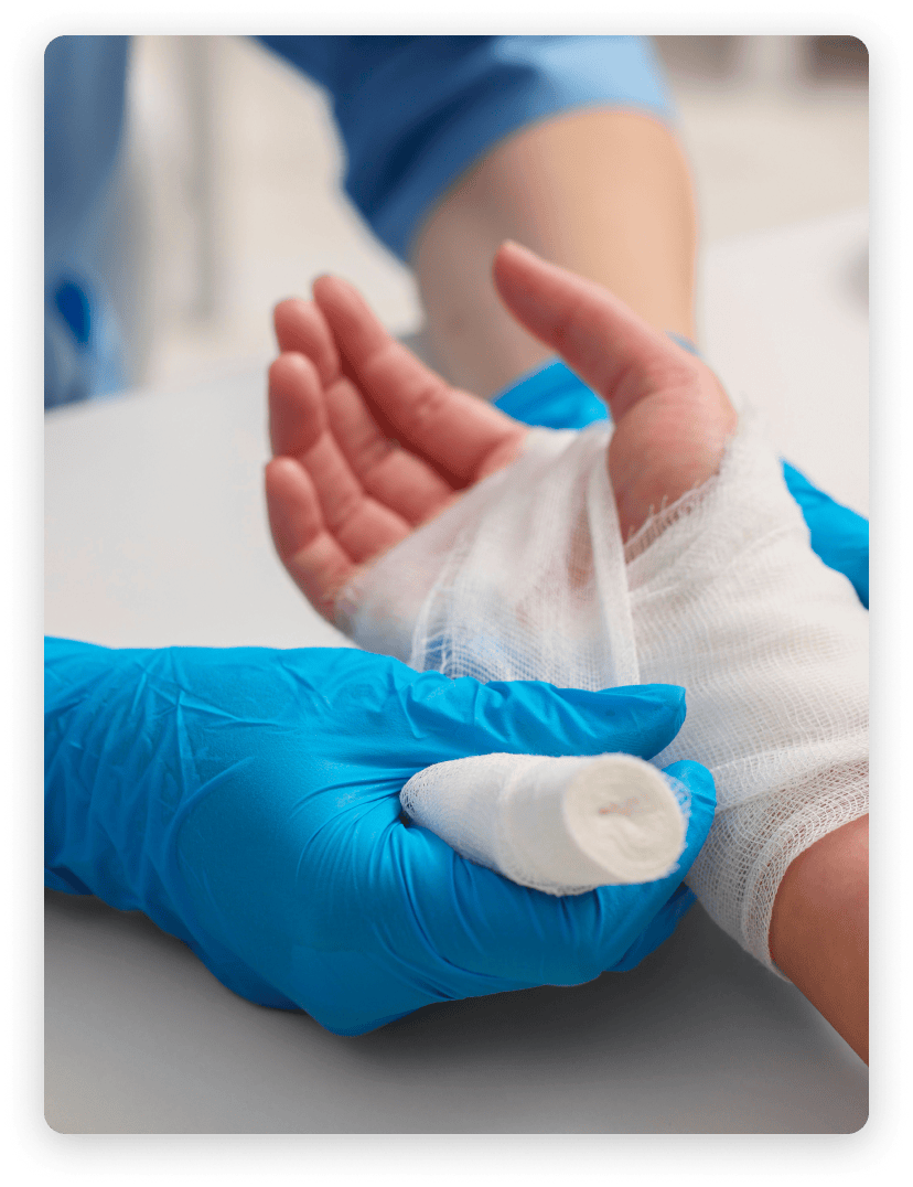 Secuelas de quemaduras